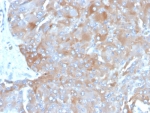 IHC staining of FFPE human adrenal gland tissue with IL-3 antibody (clone IL3/4003). HIER: boil tissue sections in pH 9 10mM Tris with 1mM EDTA for 20 min and allow to cool before testing.