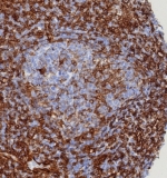 IHC staining of FFPE human spleen tissue with ERIS antibody (clone STING1/8187R). HIER: boil tissue sections in pH 9 10mM Tris with 1mM EDTA for 20 min and allow to cool before testing.