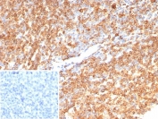 IHC staining of FFPE human tonsil tissue with CD74 antibody (clone CLIP/7192) at 2ug/ml. Inset: PBS used in place of primary Ab (secondary Ab negative control). HIER: boil tissue sections in pH 9 10mM Tris with 1mM EDTA for 20 min and allow to cool before testing.
