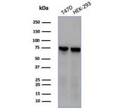 Western blot testing of human T-47D & HEK293 cell lysates using HSPA1B antibody (clone HSPA1B/7623). Expected molecular weight ~70 kDa.
