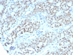 IHC staining of FFPE human fallopian tube tissue with BTBD9 antibody (clone BTBD9/7501). HIER: boil tissue sections in pH 9 10mM Tris with 1mM EDTA for 20 min and allow to cool before testing.