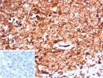 IHC staining of FFPE human tonsil tissue with HLA-DR antibody (clone HLA-DRA/6840R). Inset: PBS used in place of primary Ab (secondary Ab negative control). HIER: boil tissue sections in pH 9 10mM Tris with 1mM EDTA for 20 min and allow to cool before testing.