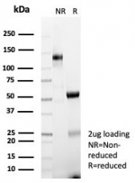 SDS-PAGE analysis of purified, BSA-free HLA-ABC antibody (clone MHC-I/8366R) as confirmation of integrity and purity.