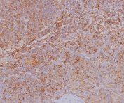 IHC staining of FFPE human tonsil tissue with HLA-ABC antibody (clone MHC-I/8366R). HIER: boil tissue sections in pH 9 10mM Tris with 1mM EDTA for 20 min and allow to cool before testing.