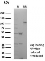 SDS-PAGE analysis of purified, BSA-free Pan-HLA antibody (clone rHLA-Pan/8847) as confirmation of integrity and purity.