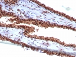 IHC staining of FFPE human prostate tissue with Heat shock 70 kDa protein 1B antibody (clone HSPA1B/7629). HIER: boil tissue sections in pH 9 10mM Tris with 1mM EDTA for 20 min and allow to cool before testing.