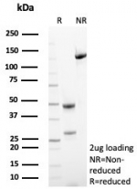 SDS-PAGE analysis of purified, BSA-free HLA-G antibody (clone HLAG/8393R) as confirmation of integrity and purity.