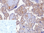 IHC staining of FFPE human placental tissue with HLA-G antibody (clone HLAG/8344R). Inset: PBS used in place of primary Ab (secondary Ab negative control). HIER: boil tissue sections in pH 9 10mM Tris with 1mM EDTA for 20 min and allow to cool before testing.