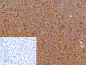 IHC staining of FFPE human tonsil tissue with HLA-G antibody (clone HLAG/8344R). Inset: PBS used in place of primary Ab (secondary Ab negative control). HIER: boil tissue sections in pH 9 10mM Tris with 1mM EDTA for 20 min and allow to cool before testing.