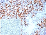 IHC staining of FFPE human tonsil tissue with IRF4 antibody (clone MUM1/8274R). Inset: PBS used in place of primary Ab (secondary Ab negative control). HIER: boil tissue sections in pH 9 10mM Tris with 1mM EDTA for 20 min and allow to cool before testing.