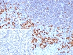 IHC staining of FFPE human tonsil tissue with Interferon regulatory factor 4 antibody (clone MUM1/8560R). Inset: PBS used in place of primary Ab (secondary Ab negative control). HIER: boil tissue sections in pH 9 10mM Tris with 1mM EDTA for 20 min and allow to cool before testing.
