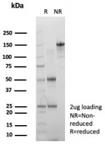 SDS-PAGE analysis of purified, BSA-free Estrogen Receptor alpha antibody (clone rESR1/8761) as confirmation of integrity and purity.
