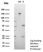 SDS-PAGE analysis of purified, BSA-free HCG-alpha antibody (clone hCGa/7870) as confirmation of integrity and purity.