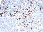 IHC staining of FFPE human kidney tissue with Fascin 1 antibody (clone FSCN1/7207) at 2ug/ml. Inset: PBS used in place of primary Ab (secondary Ab negative control). HIER: boil tissue sections in pH 9 10mM Tris with 1mM EDTA for 20 min and allow to cool before testing.