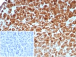 IHC staining of FFPE human pancreas tissue with Carboxypeptidase A1 antibody (clone rCPA1/8518). Inset: PBS used in place of primary Ab (secondary Ab negative control). HIER: boil tissue sections in pH 9 10mM Tris with 1mM EDTA for 20 min and allow to cool before testing.