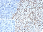 IHC staining of FFPE human tonsil tissue with EZH2 antibody (clone EZH2/6991). Inset: PBS used in place of primary Ab (secondary Ab negative control). HIER: boil tissue sections in pH 9 10mM Tris with 1mM EDTA for 20 min and allow to cool before testing.
