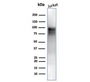 Western blot testing of human Jurkat cell lysate with Enhancer of zeste homolog 2 antibody (clone EZH2/6988). Expected molecular weight: 85-95 kDa.