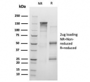 SDS-PAGE analysis of purified, BSA-free KMT6 antibody (clone EZH2/4194) as confirmation of integrity and purity.