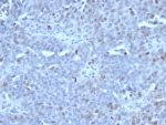 IHC staining of FFPE human tonsil tissue with EZH2 antibody (clone EZH2/6989). HIER: boil tissue sections in pH 9 10mM Tris with 1mM EDTA for 20 min and allow to cool before testing.