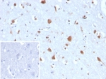 IHC staining of FFPE human brain tissue with Carbonic Anhydrase VIII antibody (clone CA8/6814). Inset: PBS used in place of primary Ab (secondary Ab negative control). HIER: boil tissue sections in pH 9 10mM Tris with 1mM EDTA for 20 min and allow to cool before testing.