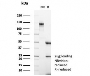 SDS-PAGE analysis of purified, BSA-free Carbonic Anhydrase 3 antibody (clone CA3/7883) as confirmation of integrity and purity.