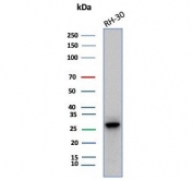 Western blot testing of human RH-30 cell lysate with Carbonic Anhydrase 3 antibody (clone CA3/7883). Predicted molecular weight ~29 kDa.