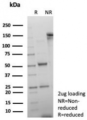 SDS-PAGE analysis of purified, BSA-free Double Stranded DNA antibody (clone rDSD/8266) as confirmation of integrity and purity.