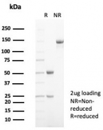 SDS-PAGE analysis of purified, BSA-free CD99 antibody (clone MIC2/7863) as confirmation of integrity and purity.