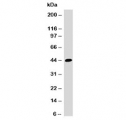 Western blot testing of HCT116 cell lysate and EpCAM antibody (EPM17-1). Expected molecular weight: ~35 kDa (unmodified), 40-43 kDa (glycosylated).