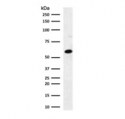 Western blot testing of human MCF7 cell lysate with Estrogen Receptor beta antibody (clone NR3Gb-1). Expected molecular weight: 53-59 kDa.