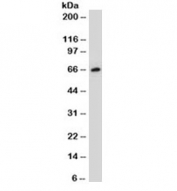 Western blot testing of MCF-7 cell lysate with ER antibody (clone NR3Ga-3). Predicted molecular weight of ER alpha: ~66 kDa.