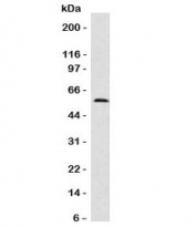 Western blot testing of Fascin antibody and human HeLa cell lysate (clone FAN55-1). Predicted molecular weight ~55 kDa.