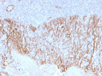 IHC testing of FFPE human tonsil tissue with Beta Catenin antibody (clone CTNNB1/2099). HIER: boil tissue sections in pH6, 10mM citrate buffer, for 10-20 min followed by cooling at RT for 20 min.~