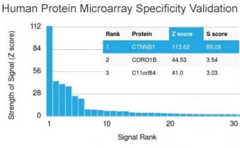 Analysis of HuProt(TM) microarray contai