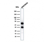 Western blot testing of human pancreas lysate with CPA1 antibody (clone CPA1/2711). Predicted molecular weight ~47 kDa.