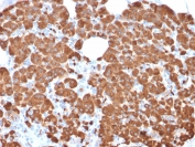 IHC staining of FFPE human pancreas with CPA1 antibody (clone CPA1/2711). HIER: boil tissue sections in pH 9 10mM Tris with 1mM EDTA for 10-20 min and allow to cool before testing.