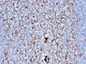 IHC staining of FFPE human tonsil with Cystatin A antibody (clone CSTA/2882). HIER: boil tissue sections in pH 9 10mM Tris with 1mM EDTA for 10-20 min and allow to cool before testing.
