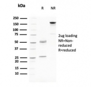 SDS-PAGE analysis of purified, BSA-free Desmoglein 3 antibody (clone DSG3/2796) as confirmation of integrity and purity.