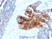 IHC staining of human ovary with recombinant TAG-72 antibody (clone CA72/2869R). HIER: boil tissue sections in pH 9 10mM Tris with 1mM EDTA for 10-20 min and allow to cool before testing.