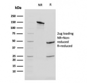 SDS-PAGE analysis of purified, BSA-free Cytokeratin 13 antibody (clone KRT13/2659) as confirmation of integrity and purity.