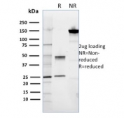 SDS-PAGE analysis of purified, BSA-free ROR2 antibody (clone ROR2/1911) as confirmation of integrity and purity.