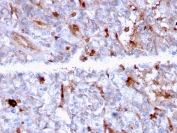 IHC staining of FFPE human kidney with C1QA antibody (clone C1QA/2956). HIER: boil tissue sections in pH 9 10mM Tris with 1mM EDTA for 10-20 min and allow to cool before testing.