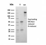 SDS-PAGE analysis of purified, BSA-free C1QA antibody (clone C1QA/2956) as confirmation of integrity and purity.