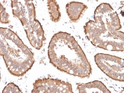 IHC staining of FFPE human small intestine with Villin antibody cocktail (clones VIL1/1314 + VIL1/2376). HIER: boil tissue sections in pH 9 10mM Tris with 1mM EDTA for 20 min and allow to cool before testing.