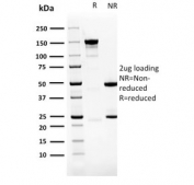 SDS-PAGE analysis of purified, BSA-free PDLIM1 antibody (clone CPTC-PDLIM1-1) as confirmation of integrity and purity.
