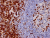 IHC staining of FFPE human lymph node with CD7 antibody (clone CD7/3737). HIER: boil tissue sections in pH 9 10mM Tris with 1mM EDTA for 20 min and allow to cool before testing.