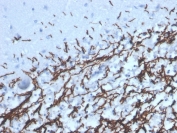IHC staining of FFPE human brain with recombinant Myelin Basic Protein antibody (clone MBP/4277R). HIER: boil tissue sections in pH 9 10mM Tris with 1mM EDTA for 20 min and allow to cool before testing.