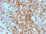 IHC staining of FFPE human tonsil with CD43 antibody. HIER: boil tissue sections in pH 9 10mM Tris with 1mM EDTA for 20 min and allow to cool before testing.