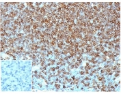 IHC staining of FFPE human lymph node tissue with Pan-HLA antibody (clone HLA-Pan/6663). Negative control inset: PBS instead of primary antibody to control for secondary binding. HIER: boil tissue sections in pH 9 10mM Tris with 1mM EDTA for 20 min and allow to cool before testing.