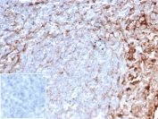 IHC staining of FFPE human tonsil tissue with CD63 antibody (clone LAMP3/4949) at 1ug/ml. Negative control inset: PBS instead of primary antibody to control for secondary binding. HIER: boil tissue sections in pH 9 10mM Tris with 1mM EDTA for 20 min and allow to cool before testing.